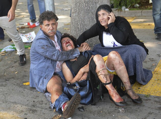 span class='image-component__caption' itemprop=captionWounded people wait for assistance during a site of an blast in Ankara, Turkey, on Oct. 10, 2015./span