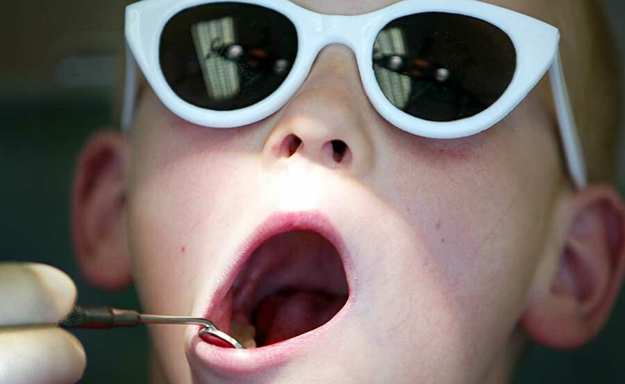 Number of children requiring dental caring keeps rising in England